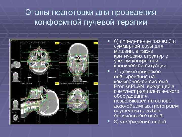 Этапы подготовки для проведения конформной лучевой терапии § 6) определение разовой и суммарной дозы