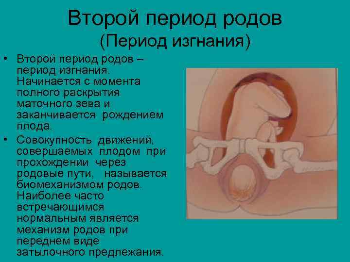 Второй период родов (Период изгнания) • Второй период родов – период изгнания. Начинается с
