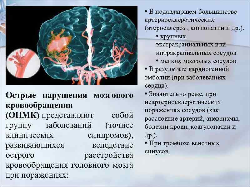 Острые нарушения мозгового кровообращения (ОНМК) представляют собой группу заболеваний (точнее клинических синдромов), развивающихся вследствие