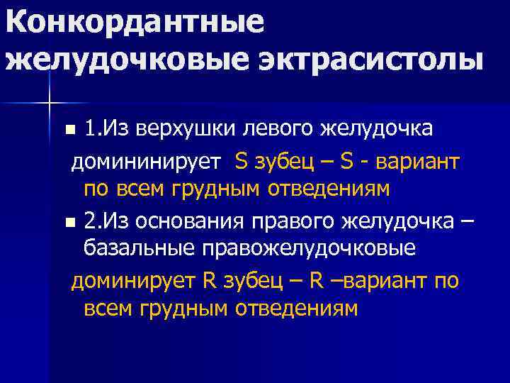 Конкордантные желудочковые эктрасистолы 1. Из верхушки левого желудочка домининирует S зубец – S -