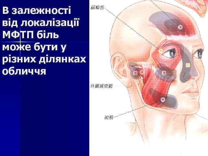 В залежності від локалізації МФТП біль може бути у різних ділянках обличчя 