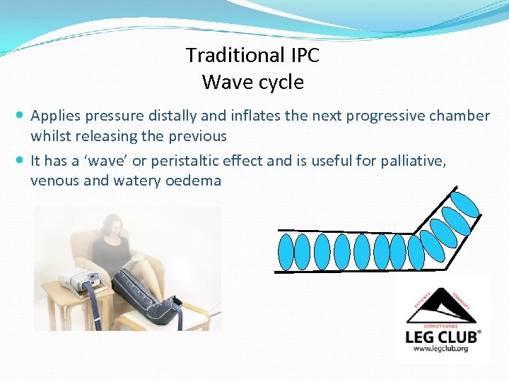 Traditional IPC Wave cycle Applies pressure distally and inflates the next progressive chamber whilst