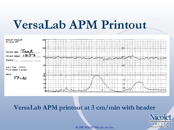 Versa. Lab APM Printout Versa. Lab APM printout at 3 cm/min with header ©