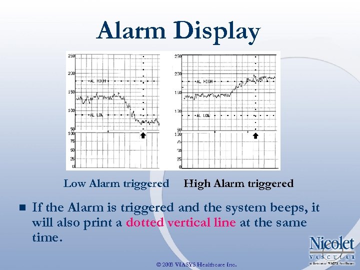Alarm Display Low Alarm triggered n High Alarm triggered If the Alarm is triggered