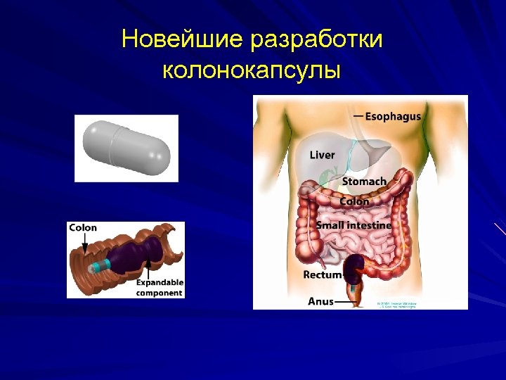 Новейшие разработки колонокапсулы 