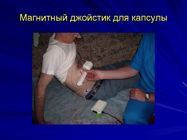 Магнитный джойстик для капсулы 