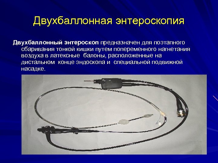 Двухбаллонная энтероскопия Двухбаллонный энтероскоп предназначен для поэтапного сбаривания тонкой кишки путем попеременного нагнетания воздуха