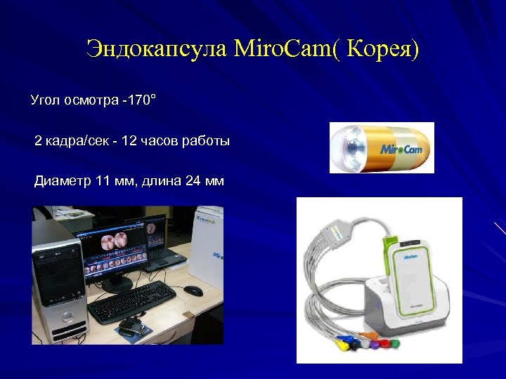 Эндокапсула Miro. Cam( Корея) Угол осмотра -170° 2 кадра/сек - 12 часов работы Диаметр