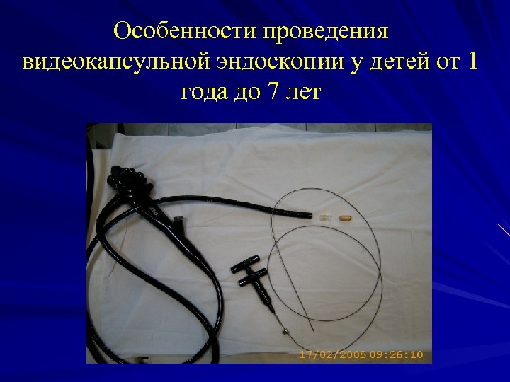 Особенности проведения видеокапсульной эндоскопии у детей от 1 года до 7 лет 