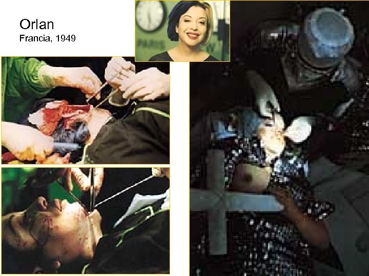 Orlan Francia, 1949 