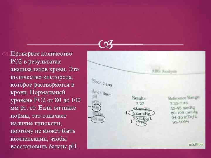  Проверьте количество РО 2 в результатах анализа газов крови. Это количество кислорода, которое