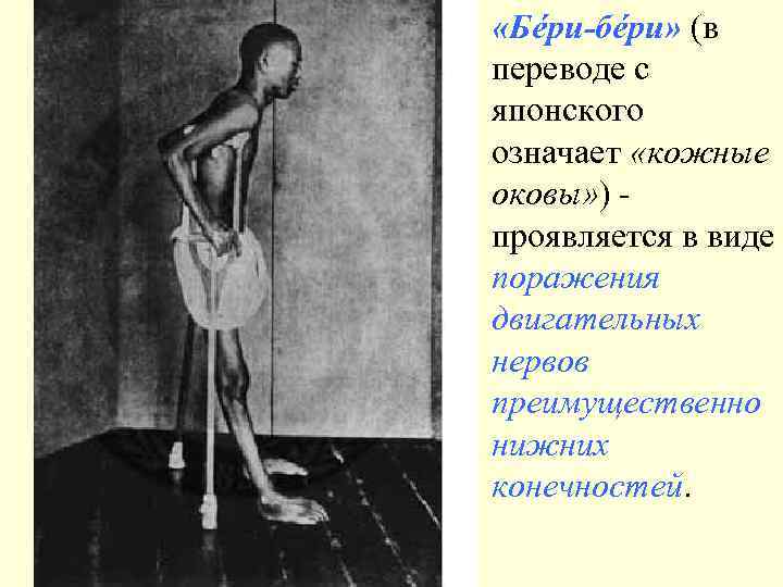  «Бéри-бéри» (в переводе с японского означает «кожные оковы» ) проявляется в виде поражения