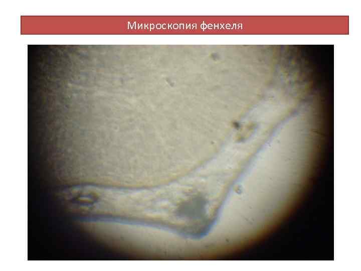 Микроскопия фенхеля 