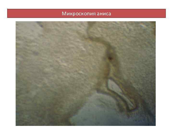 Микроскопия аниса 