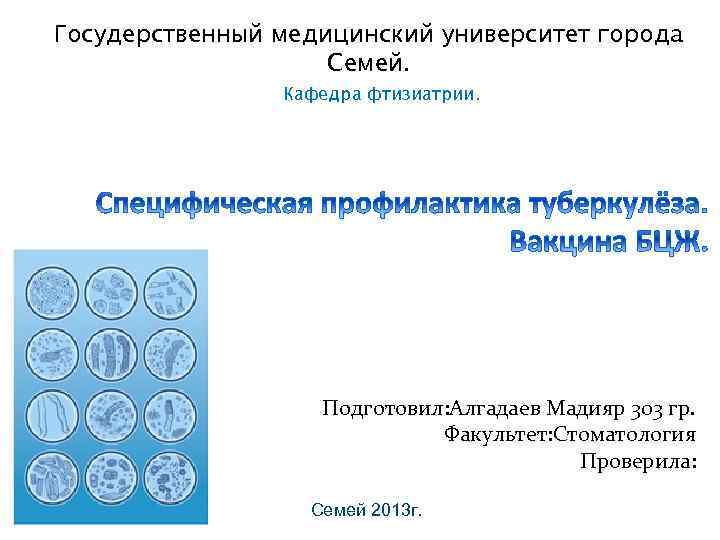 Госудерственный медицинский университет города Семей. Кафедра фтизиатрии. Подготовил: Алгадаев Мадияр 303 гр. Факультет: Стоматология