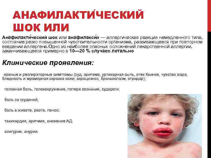 АНАФИЛАКТИ ЧЕСКИЙ ШОК ИЛИ Анафилакти ческий шок или анафилакси я — аллергическая реакция немедленного