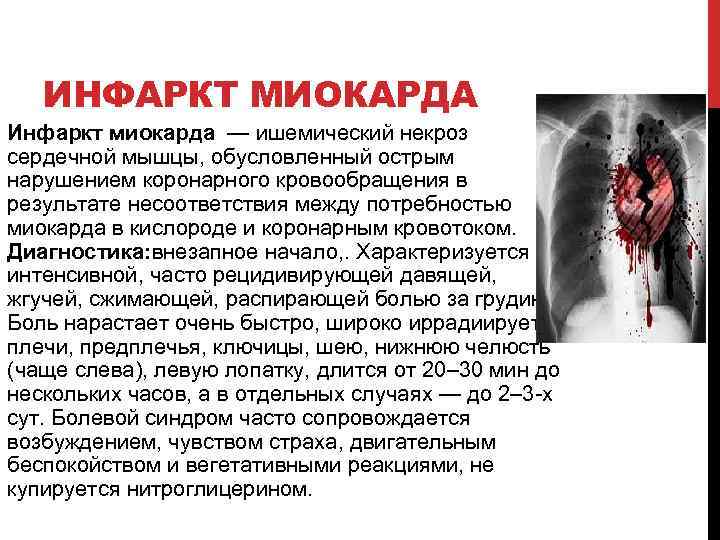 ИНФАРКТ МИОКАРДА Инфаркт миокарда — ишемический некроз сердечной мышцы, обусловленный острым нарушением коронарного кровообращения