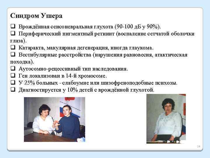 Синдром Ушера q Врождённая сенсоневральная глухота (90 -100 д. Б у 90%). q Периферический