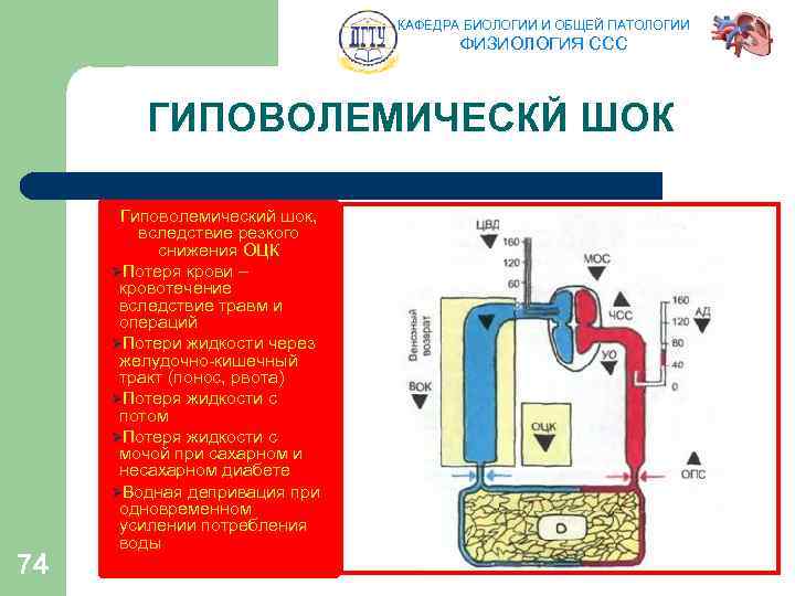 КАФЕДРА БИОЛОГИИ И ОБЩЕЙ ПАТОЛОГИИ ФИЗИОЛОГИЯ ССС ГИПОВОЛЕМИЧЕСКЙ ШОК 74 Гиповолемический шок, вследствие резкого