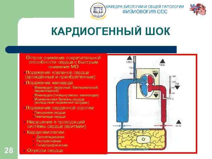 КАФЕДРА БИОЛОГИИ И ОБЩЕЙ ПАТОЛОГИИ ФИЗИОЛОГИЯ ССС КАРДИОГЕННЫЙ ШОК Острое снижение сократительной способности сердца