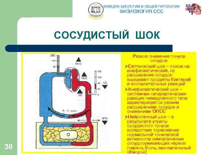 КАФЕДРА БИОЛОГИИ И ОБЩЕЙ ПАТОЛОГИИ ФИЗИОЛОГИЯ ССС СОСУДИСТЫЙ ШОК 30 Резкое снижение тонуса сосудов