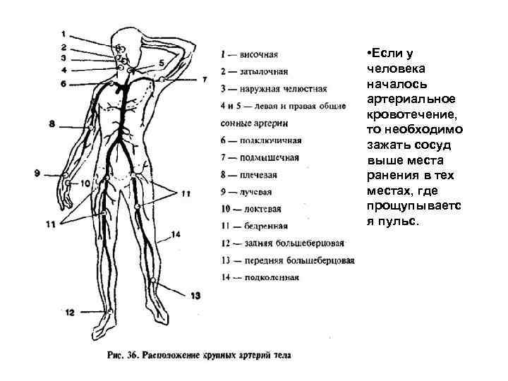  • Если у человека началось артериальное кровотечение, то необходимо зажать сосуд выше места