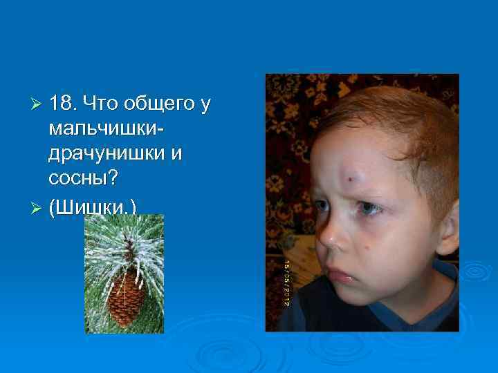Ø 18. Что общего у мальчишкидрачунишки и сосны? Ø (Шишки. ) 