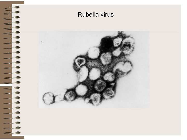 Rubella virus 