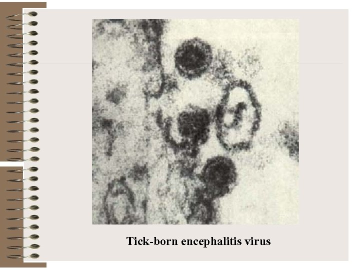 Tick-born encephalitis virus 
