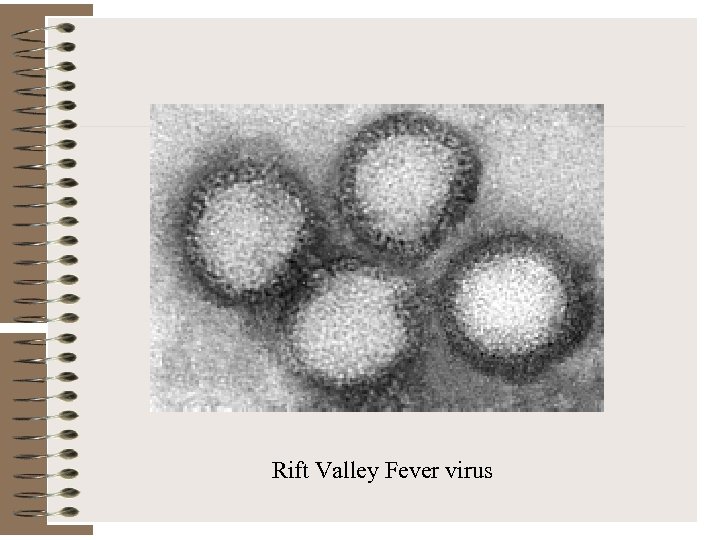 Rift Valley Fever virus 