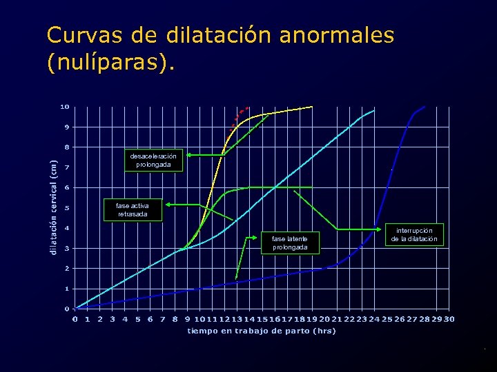 Curvas de dilatación anormales (nulíparas). desaceleración prolongada fase activa retrasada fase latente prolongada interrupción