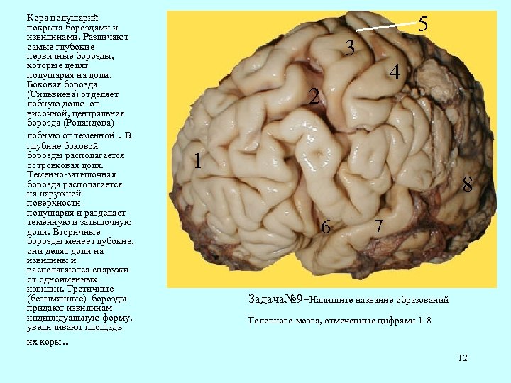 Извилины мозга картинки