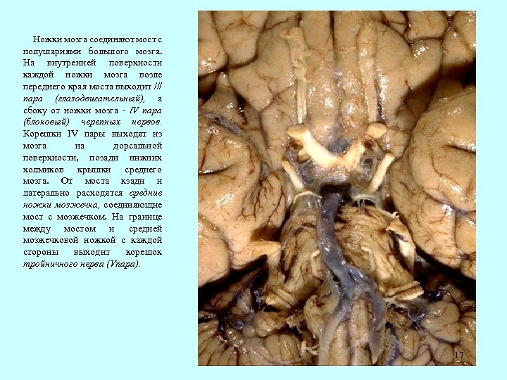 Ножки мозга соединяют мост с полушариями большого мозга. На внутренней поверхности каждой ножки мозга