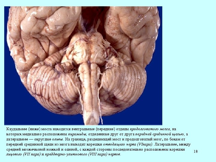 Каудальнее (ниже) моста находятся вентральные (передние) отделы продолговатого мозга, на которых медиально расположены пирамиды,