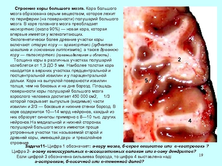 Строение коры большого мозга. Кора большого мозга образована серым веществом, которое лежит по периферии