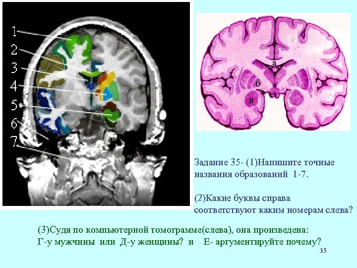 а б в Задание 35 (1)Напишите точные названия образований 1 7. (2)Какие буквы справа