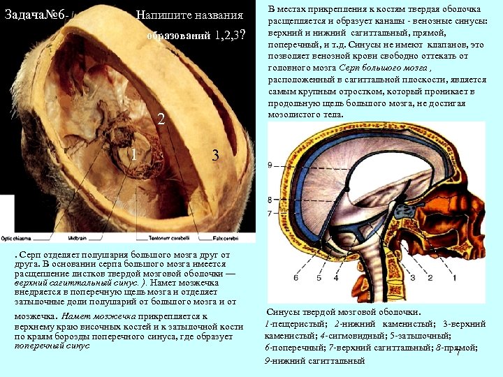 Задача№ 6 Напишите названия образований 1, 2, 3? 2 1 В местах прикрепления к