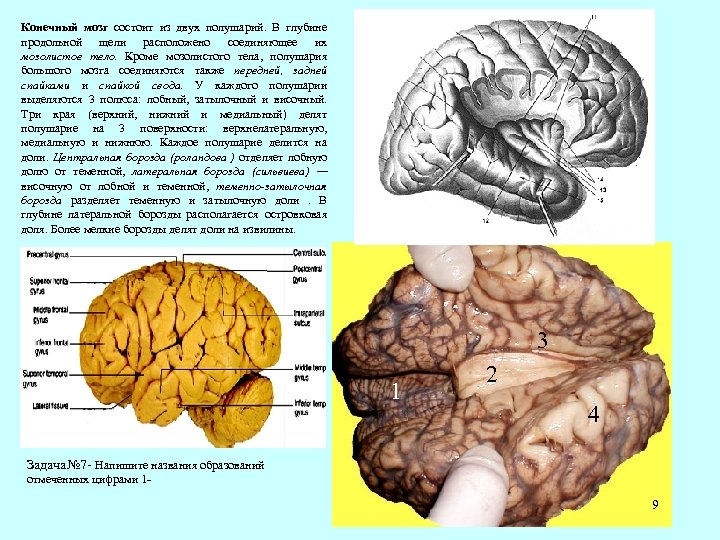 Конечный мозг состоит из двух полушарий. В глубине продольной щели расположено соединяющее их мозолистое