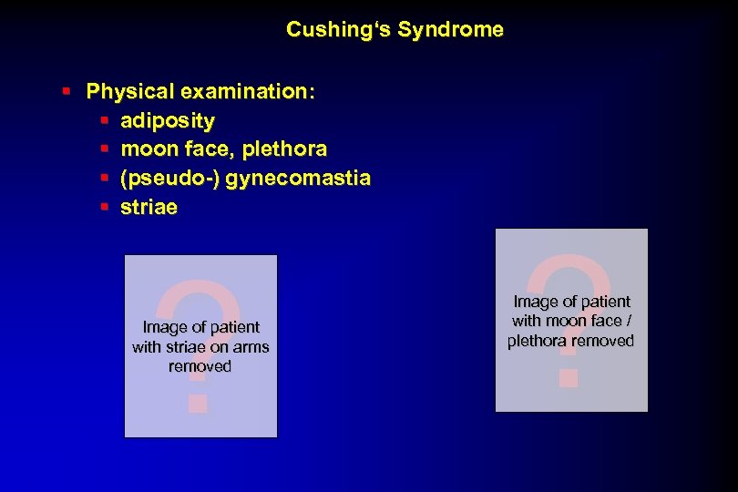 Cushing‘s Syndrome § Physical examination: § adiposity § moon face, plethora § (pseudo-) gynecomastia