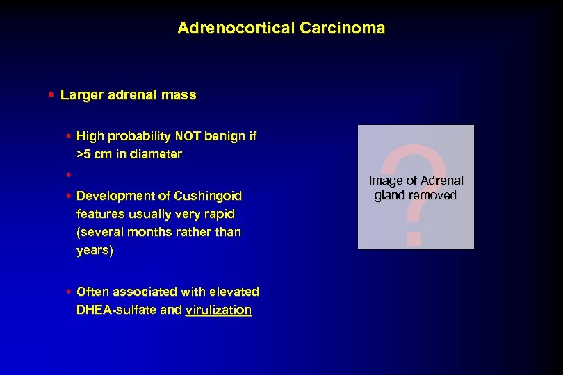 Adrenocortical Carcinoma § Larger adrenal mass § High probability NOT benign if >5 cm