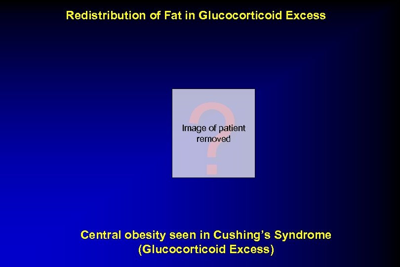 Redistribution of Fat in Glucocorticoid Excess ? Image of patient removed Central obesity seen