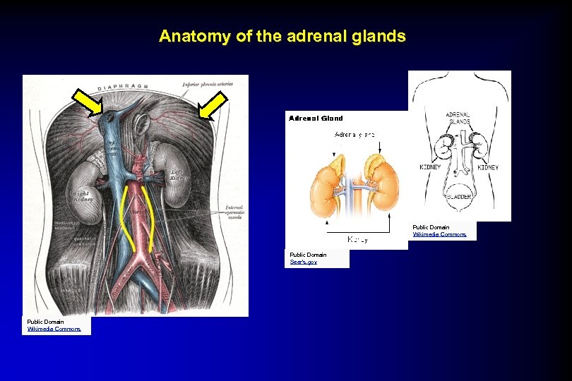 Anatomy of the adrenal glands Public Domain Wikimedia Commons Public Domain Seer’s. gov Public