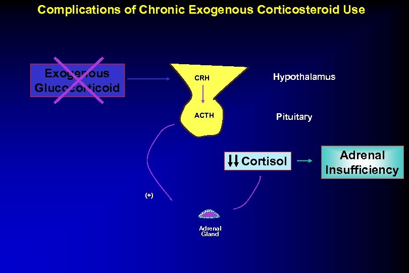 Complications of Chronic Exogenous Corticosteroid Use Exogenous Glucocorticoid CRH ACTH Hypothalamus Pituitary Cortisol (+)