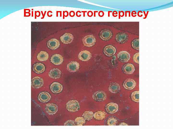 Вірус простого герпесу 