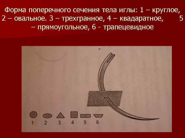 Форма поперечного сечения тела иглы: 1 – круглое, 2 – овальное. 3 – трехгранное,