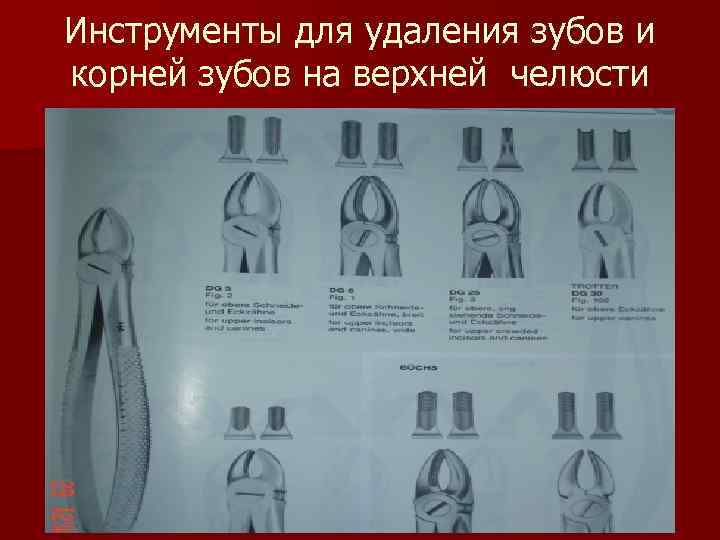 Инструменты для удаления зубов презентация