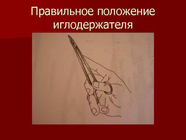 Правильное положение иглодержателя 