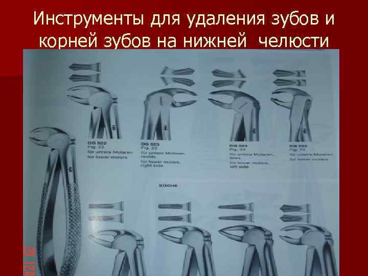 Щипцы для удаления зубов нижней челюсти с названиями и фото