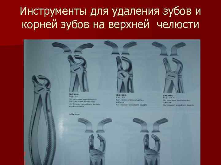 Инструменты для удаления зубов и корней зубов на верхней челюсти 