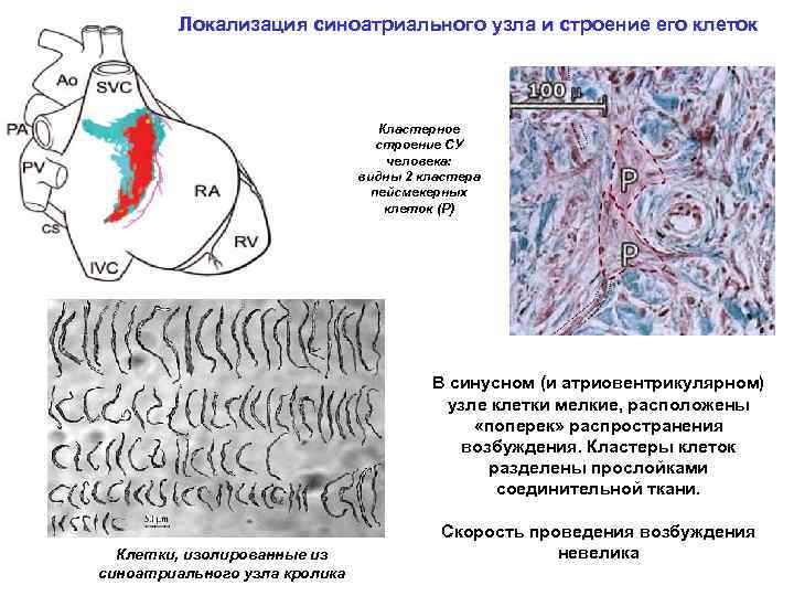 Локализация синоатриального узла и строение его клеток Кластерное строение СУ человека: видны 2 кластера